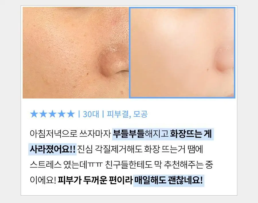 [피지제거/필링] 페이스팩토리 제트 필링기 상세페이지 14